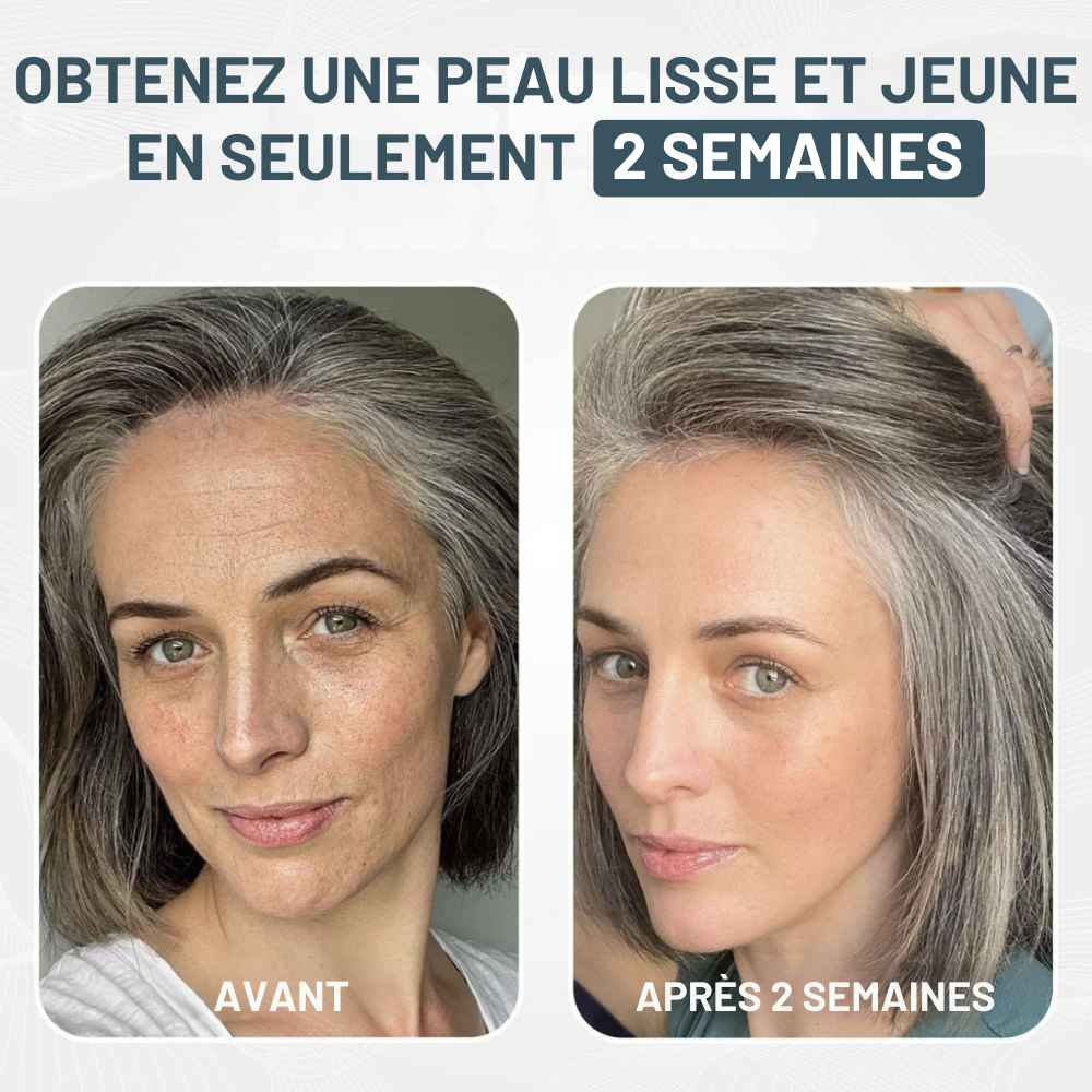 Kit Micro-Infusion Miaxa™ Solution Anti-Âge