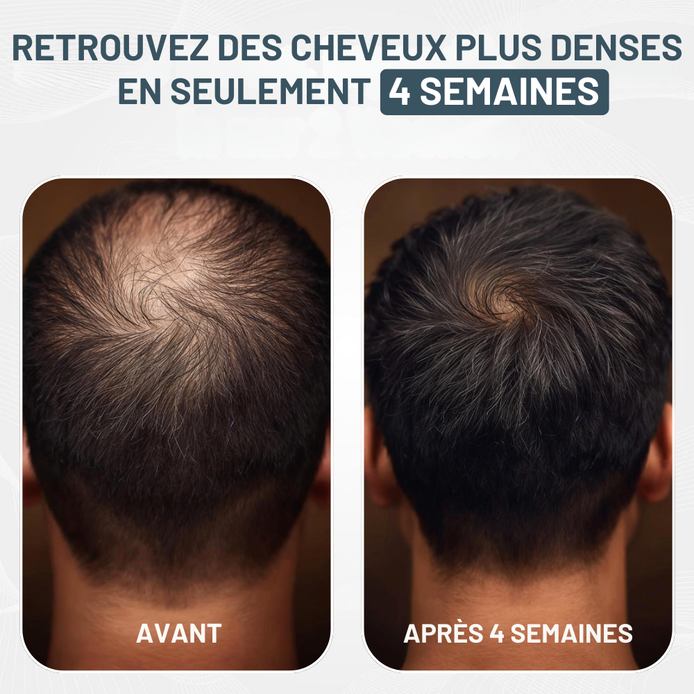 Kit Micro-Infusion Miaxa™ Solution Capillaire